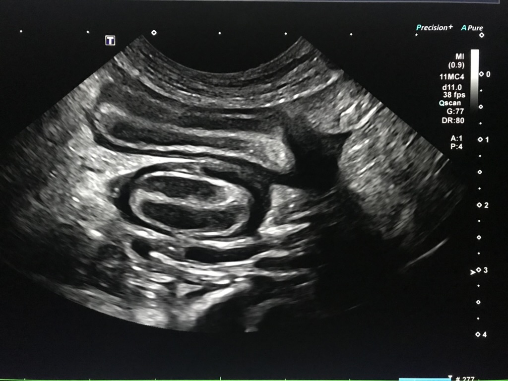 824F71C9 5B2B 43CD 92E8 DBDA8A55056D 1 105 c