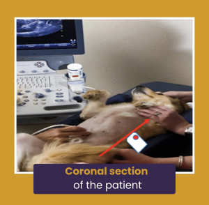 Coronal section of the patient